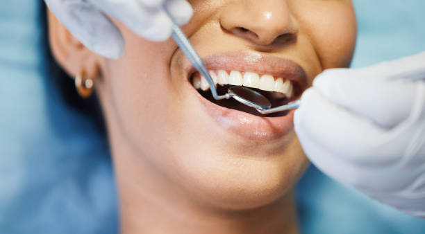 Best Emergency Treatment for Dental Infections or Abscesses in Pasadena Hills, FL